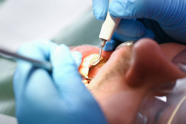 Best Chipped Tooth Repair Near Me  in Dakota Dunes, SD
